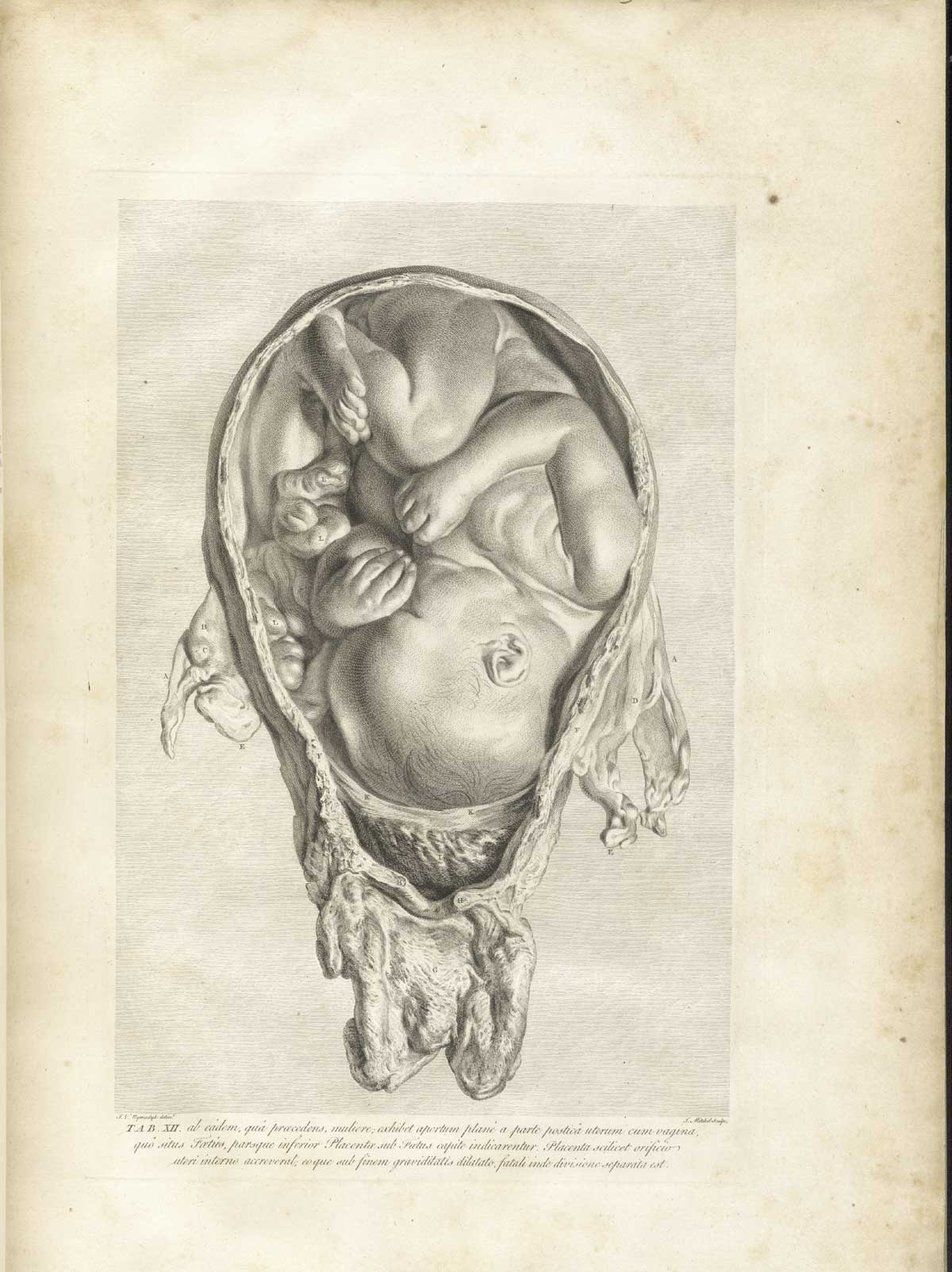 umbilical cord drawing