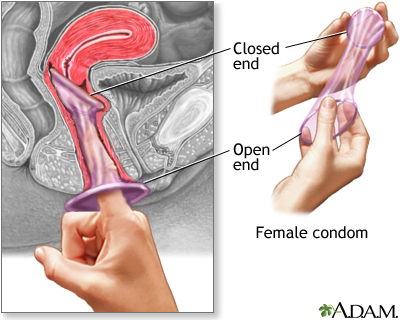 Penis Inside A Woman S Vagina 108