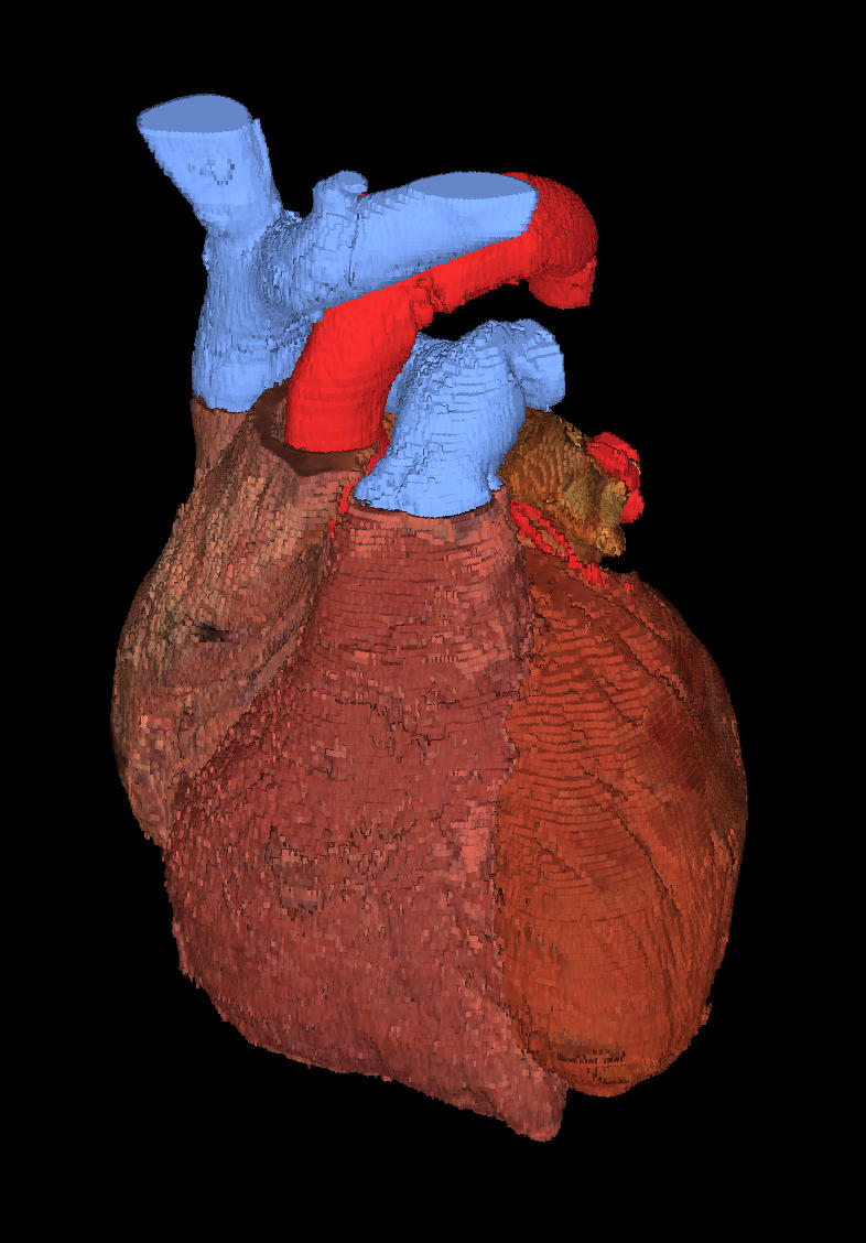 Human Heart Texture