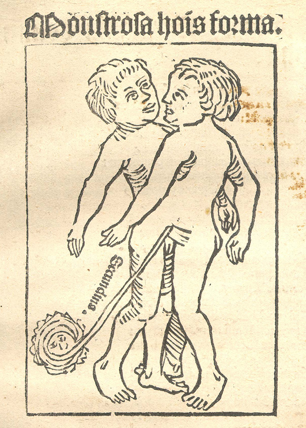 A simple woodcut illustration of two young children closely joined, facing each other.