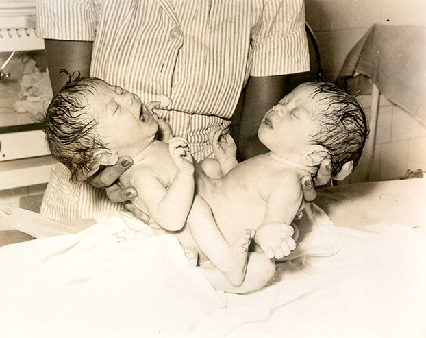 A black and white photograph of an adult holding the newborn twins on a table.