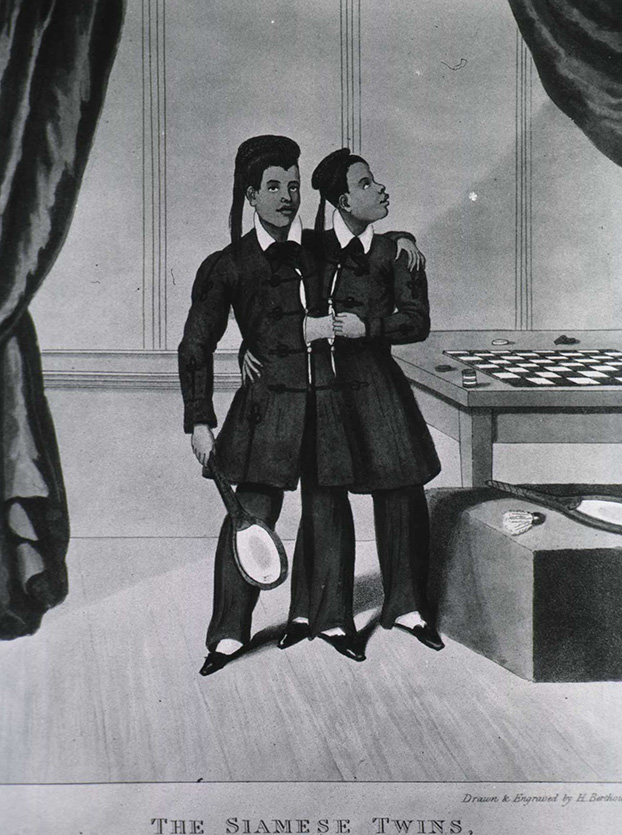 Two well-dressed young men, joined at the abdomen by an exposed band of tissue, stand together on a stage beside a chess board; the man on the left holds a badminton racquet.