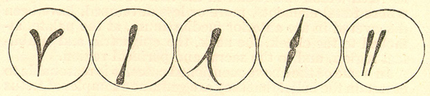 An illustration of five examples of conjoined twins showing the variation of connected germ segments.
